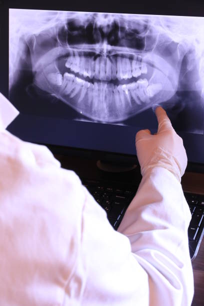 Best Emergency Gum Pain Relief  in Central City, IA